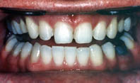 Dr Andor prepared teeth