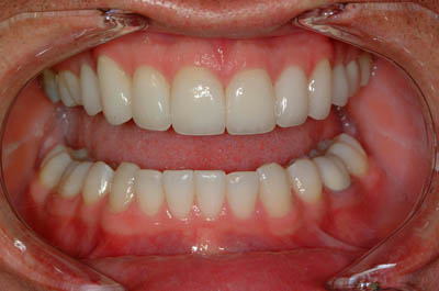 Dr. Andor's teeth after